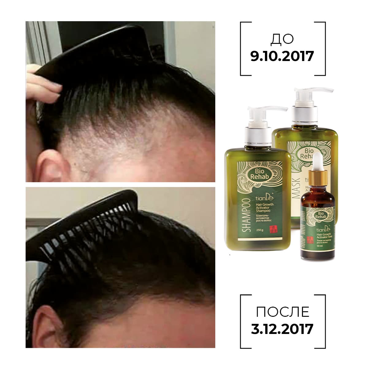 Шампунь-активатор роста волос Bio Rehab - view 8